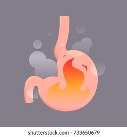 Illustration Acid Reflux Heartburn Cartoon Vector Stock Vector Royalty