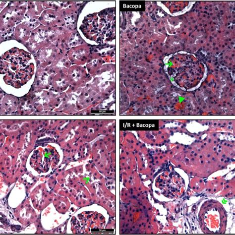 Representative Photomicrographs Of Hematoxylin And Eosin Stained