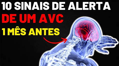 10 Sinais de ALERTA de AVC UM MÊS ANTES SINAIS INACREDITÁVEIS