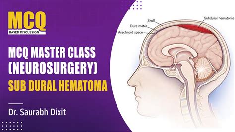 Sub Dural Hematoma Surgery Prepladder [neet Ss] Youtube