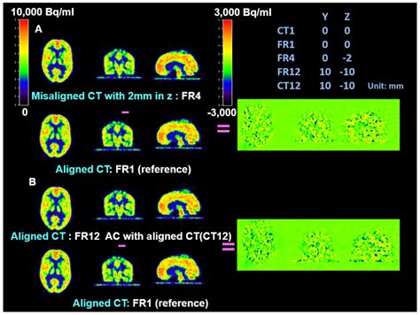 Comparison Of AC With Slightly Misaligned CT And Fully Aligned CT In