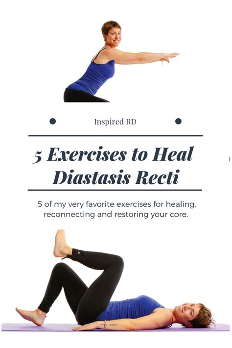 Ab Exercises To Heal Diastasis Recti Online Degrees