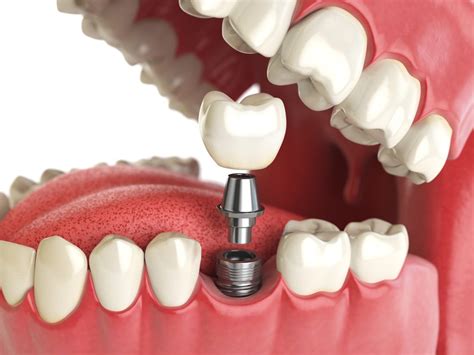 Oral And Maxillofacial Surgery