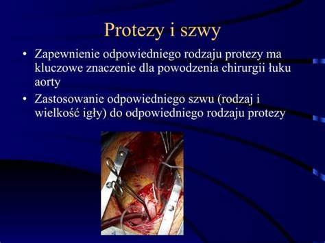 Mb Nowoczesne Metody Utrzymania Hemostazy W Kardiochirurgii Ppt