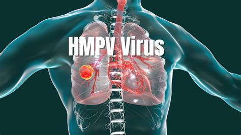 Hmpv A Respiratory Illness You Need To Know About Beaumont Emergency