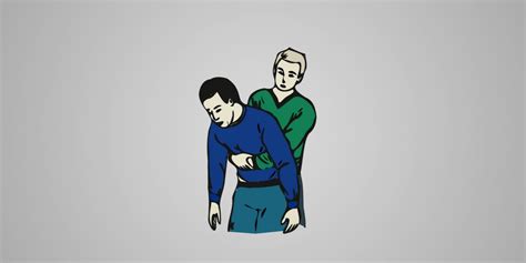 How To Perform Heimlich Maneuver Rnpedia