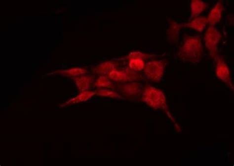 Phospho Bcl Thr Polyclonal Antibody Invitrogen L