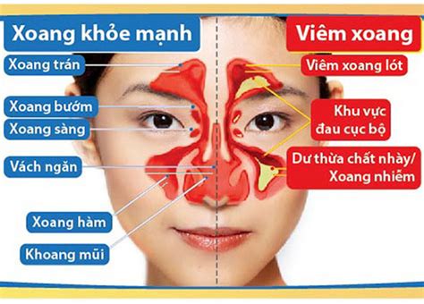 Vi M Xoang S D Ng S A Non Alpha Lipid C G Thanhhuongshop