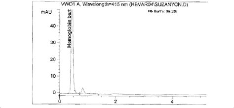 Hemoglobin Electrophoresis Of The Patient Showing High Hb Bart S