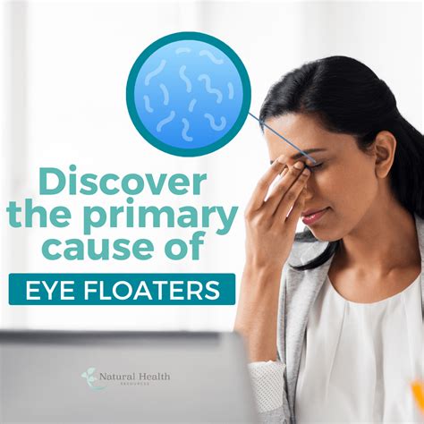 4 Ways to Treat Eye Floaters - Natural Health Resources