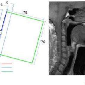 Vocal tract geometries. (a) The mid-saggital view of the MRI and 3D... | Download Scientific Diagram