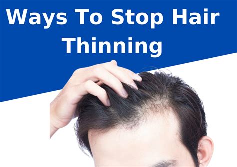 How To Stop Female Crown Hair Thinning Atelier Yuwa Ciao Jp