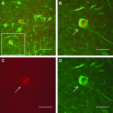 Confocal Microscopic Images Of Neurons Double Labeled With Nitric Oxide