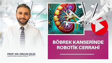 POF DR ORÇUN ÇELİK BÖBREK KANSERİNDE ROBOTİK CERRAHİNİN ÖNEMİ YouTube