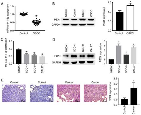 Detection Of Mir P And Pbx Expression In Oscc Tissues And Cell