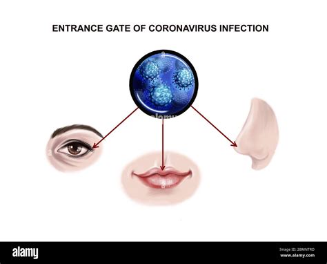 Micro S Ntomas Aclarar Puerta De Entrada Y Salida De La Infecci N