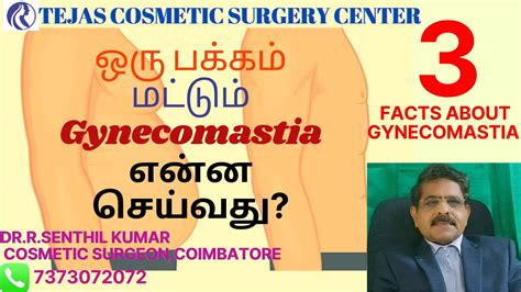 TOP 3 FACTS ABOUT GYNECOMASTIA PROF DR R SENTHIL KUMAR 7373072072 YouTube