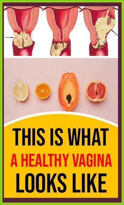 This Is What A Healthy Vagina Looks Like