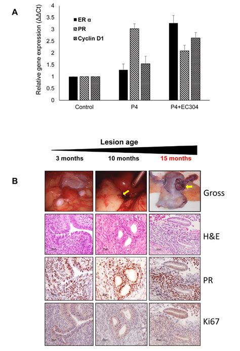 Gene Expression Of Steroid Receptors In The Baboon Endometrium Treated