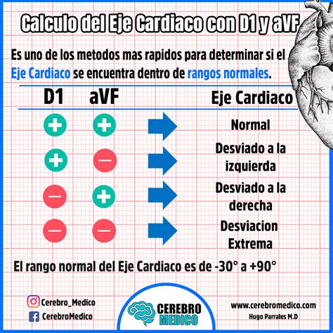 Eje Card Aco Como Calcular El Eje Card Aco En El Ekg Paso A Paso