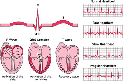 Graph For Normal Fast Slow And Irregular Heartbeats Download Scientific Diagram