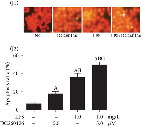 GPR40 And Its Involvement In Metformin Improves LPS Induced