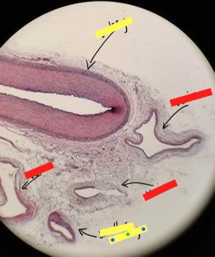 Blood Vessel Slides A P II LAB Flashcards Quizlet