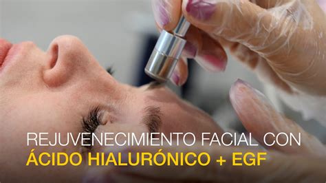 Rejuvenecimiento Facial con Ácido Hialurónico EGF YouTube