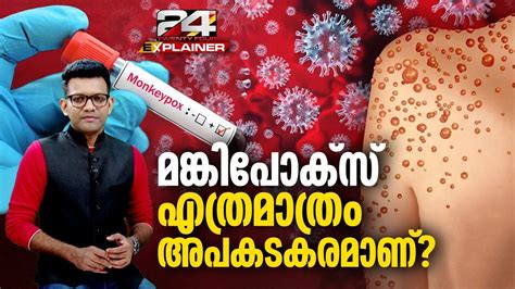 ജവൻ കവരനന Mpox പതയ വകഭദതതന മരണസധയത കടതൽ അറയണടതലല