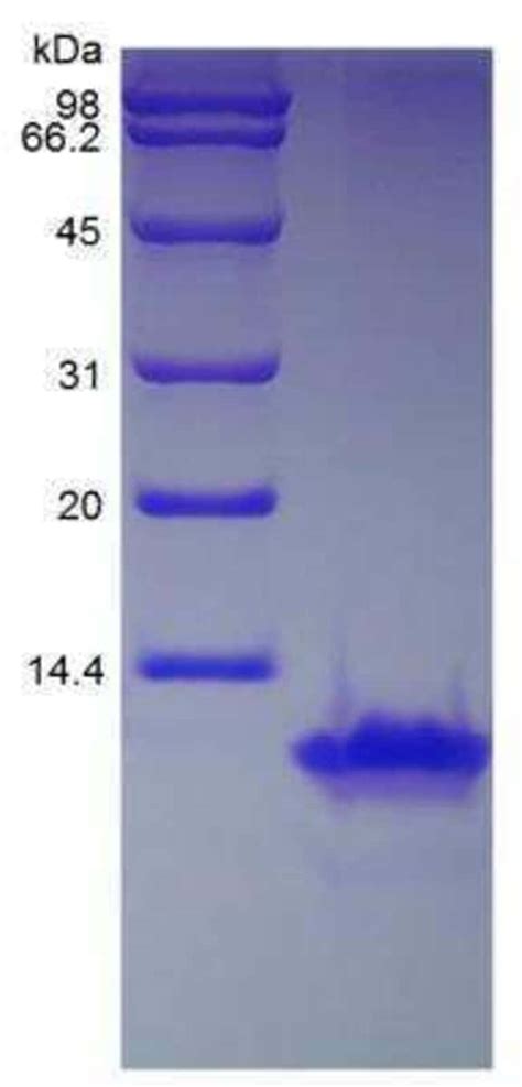 Novus Biologicals Recombinant Human CCL8 MCP 2 Protein 1 Mg Fisher