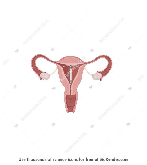 Free Female Reproductive System With IUD Icons Symbols Images