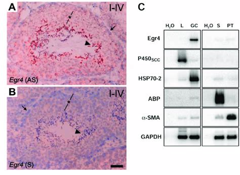 Egr4 Expression In Testicular Germ Cells A In Situ Hybridization