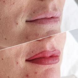 Micropigmentaci N Labios Mallorca Aumento De Labios Mallorca