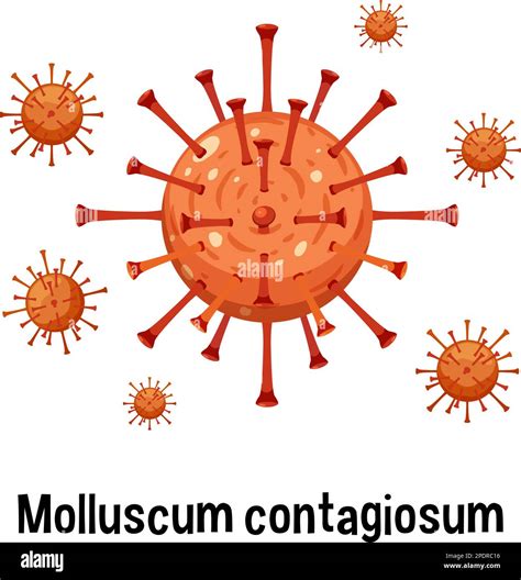 Molluscum Contagiosum With Text Illustration Stock Vector Image And Art