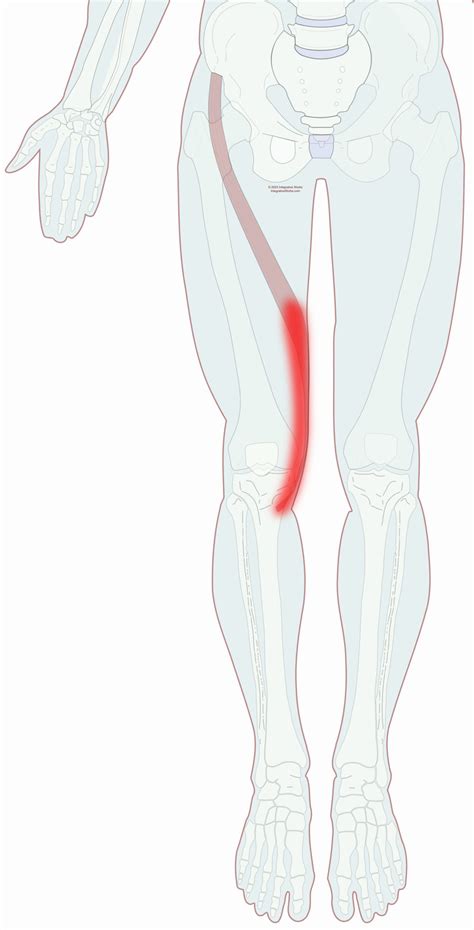 Pain Inside Knee Sometimes Across Thigh Integrative Works