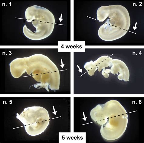 The Human Embryos Used In This Study Embryos Are Numbered From The