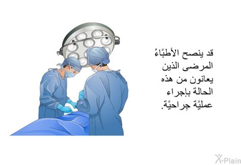 جراحة الإصبع الزنادية