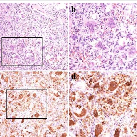 He Staining ×20 ×40 A Large Number Of Giant Cells And Stromal Cells Download Scientific