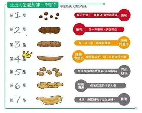 宝宝大便的7形11状你一定要了解 饮食