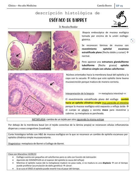 Esófago de Barret UP 19 uDocz