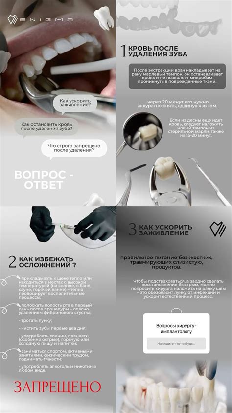 Пин от пользователя DARIA PETROVA на доске Ваши пины | Стоматология ...