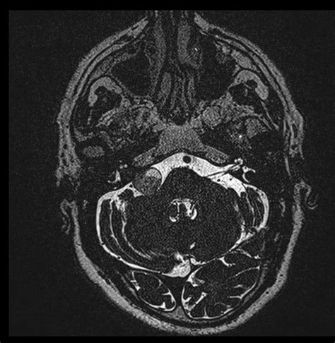 Image Radiopaedia Org