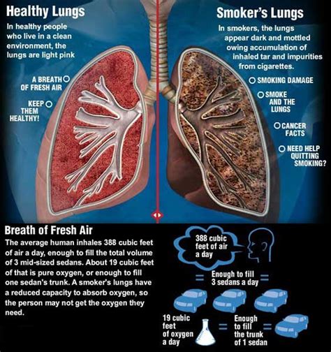 Symptoms of smokers cough and Nicotine replacement therapy - SnzKJMLWS8 ...