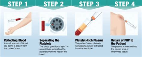 Best Platelet Rich Plasma Therapy Prp Honolulu Hawaii