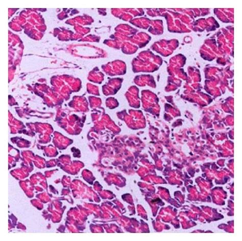 The He Staining Of Pancreas He 400x In Five Groups A Group 1