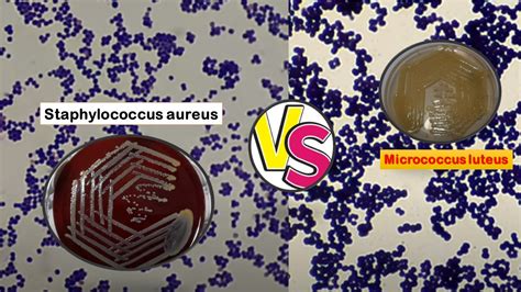 Colony Morphology Of Staphylococcus Aureus On Blood Agar Archives