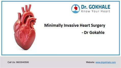 Ppt Minimally Invasive Heart Surgery Dr Gokhale Powerpoint