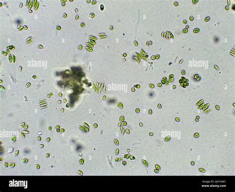 Blue green algae microscope hi-res stock photography and images - Alamy