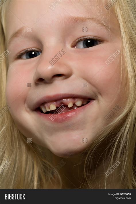 Funny Toothless Smile Image And Photo Free Trial Bigstock