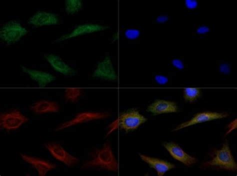 Endothelial Lipase Antibody Novus Biologicals 0 1mL Unlabeled